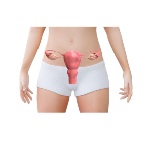 principales-causes-SOPK