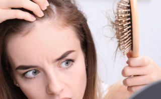 Perte de cheveux et SOPK : comment éviter l'alopécie
