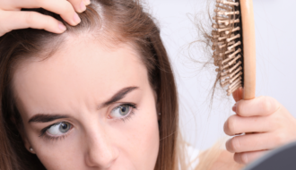 Perte de cheveux et SOPK : comment éviter l'alopécie