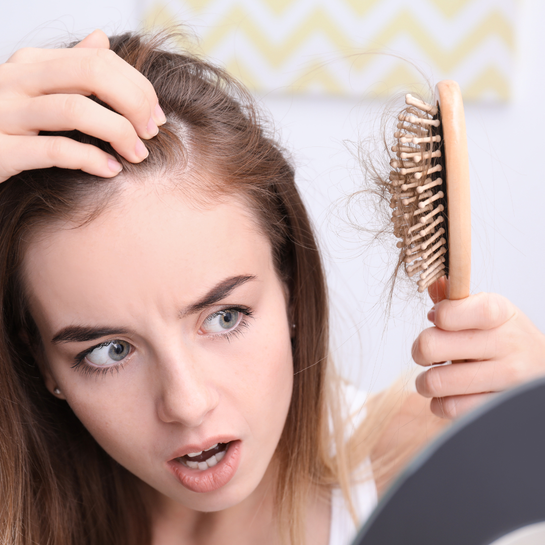 Perte de cheveux et SOPK : comment éviter l'alopécie